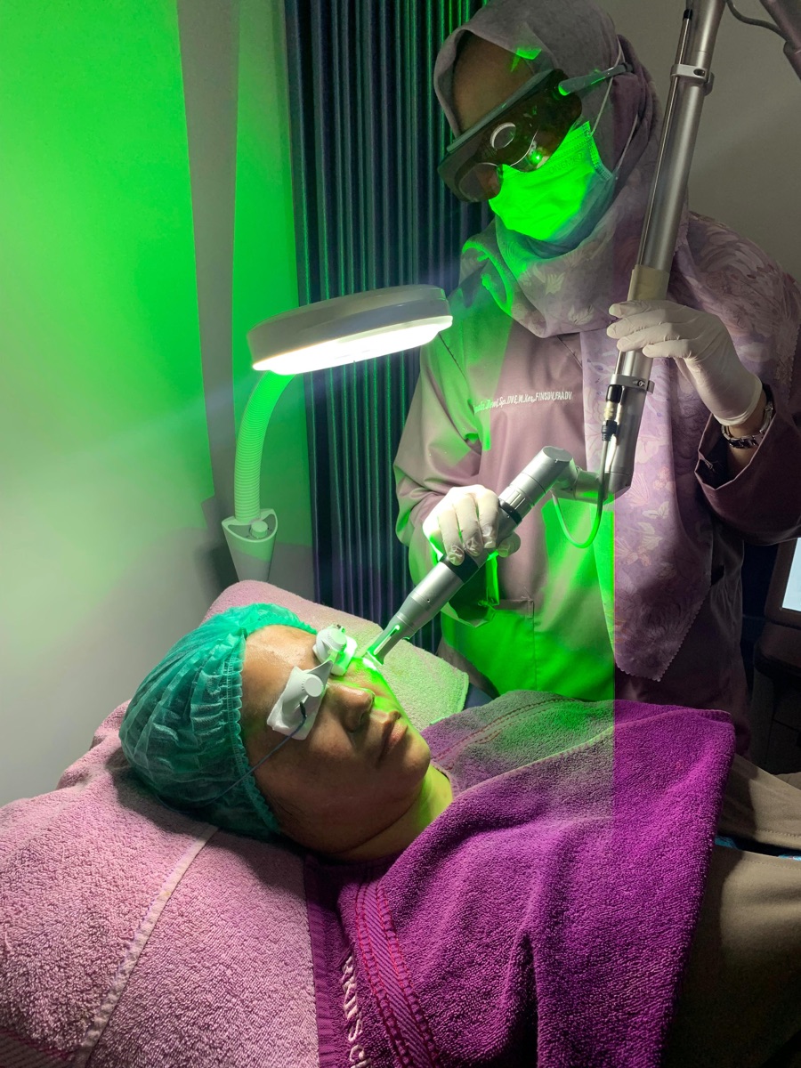 Foto alat laser